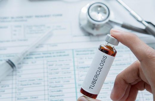 Begini Rencana Unpad yang Diminta Pimpin Riset Vaksin TB