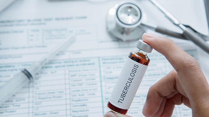 Begini Rencana Unpad yang Diminta Pimpin Riset Vaksin TB